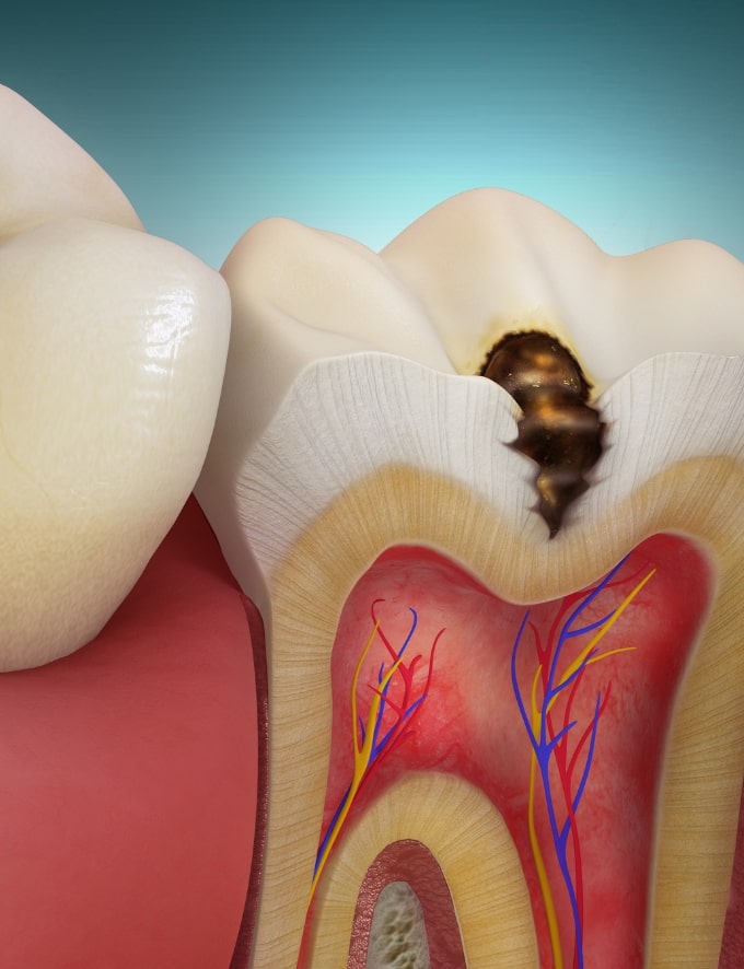 Treatment - Conway House Dental