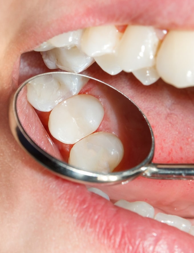 Treatment - Conway House Dental