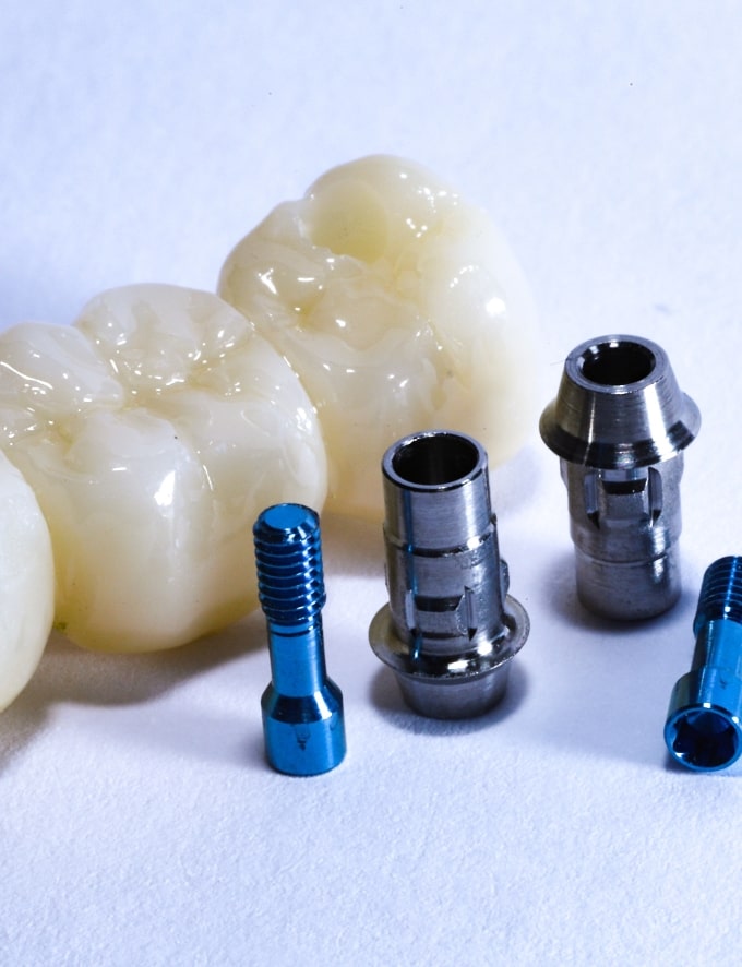 Treatment - Conway House Dental