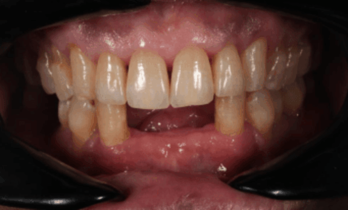 Before - Conway House Dental