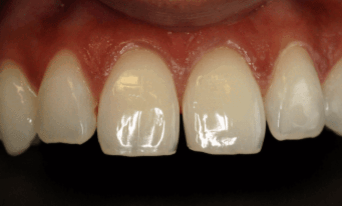 Before - Conway House Dental