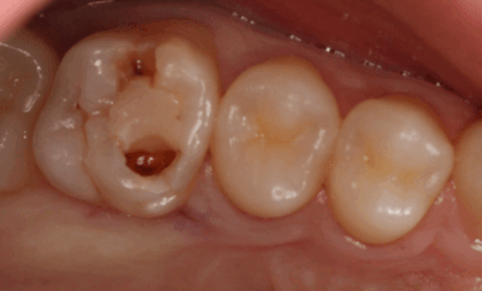 Before - Conway House Dental