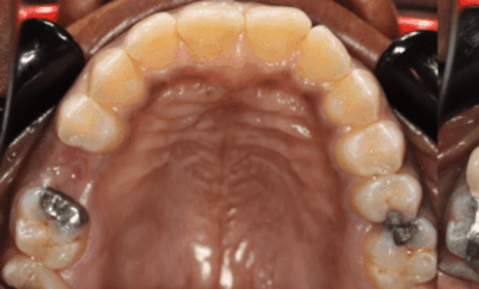 Before - Conway House Dental