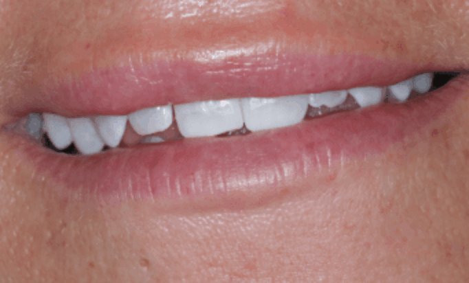 Before - Conway House Dental