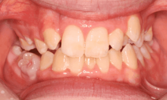 Before - Conway House Dental