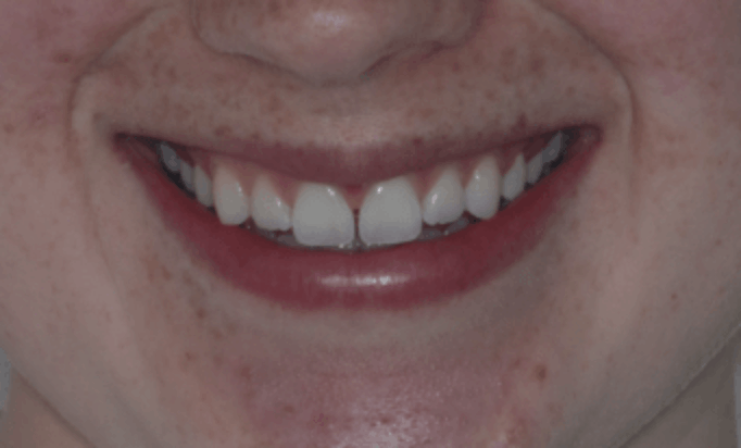 Before - Conway House Dental