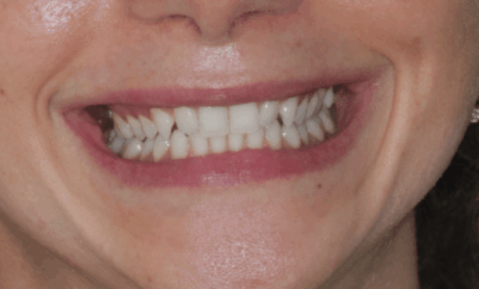 Before - Conway House Dental