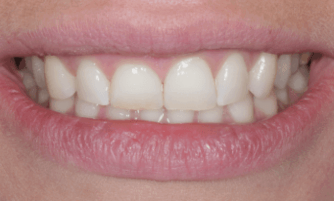 Before - Conway House Dental