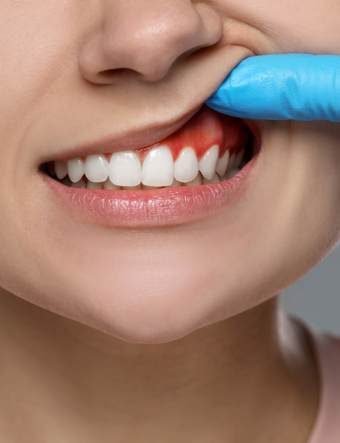 Treatment - Conway House Dental