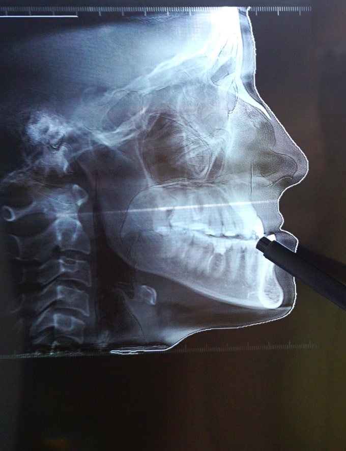 Treatment - Conway House Dental