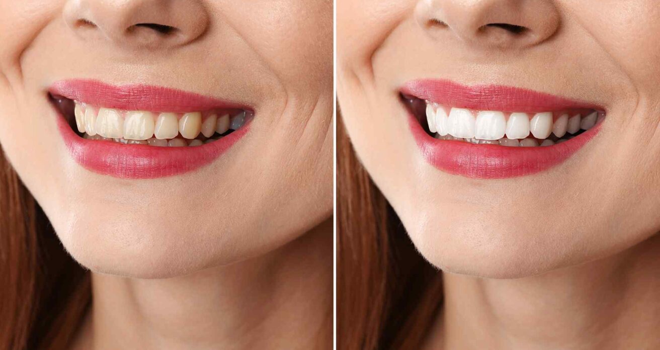 Blog -Conway House Dental