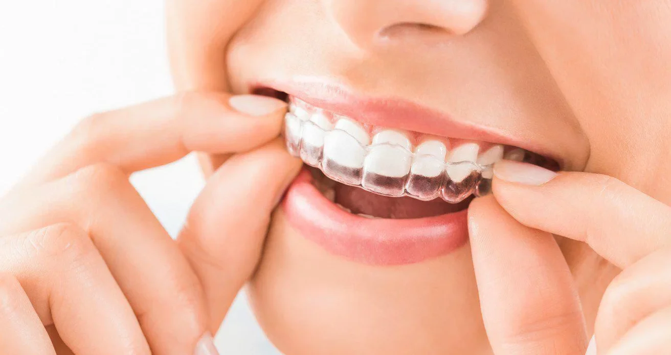 Blog -Conway House Dental