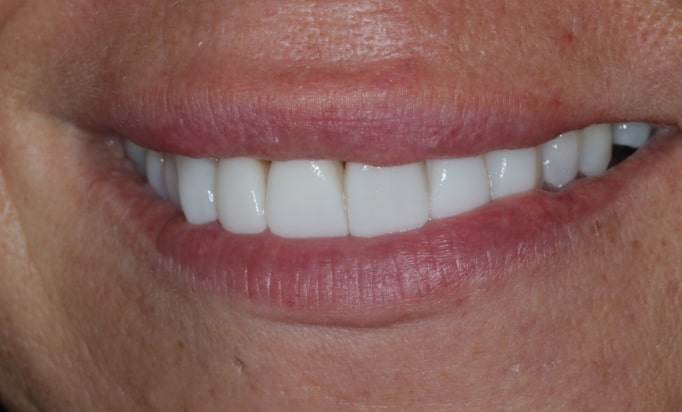 After -Conway House Dental