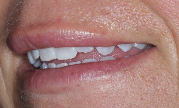 Before - Conway House Dental