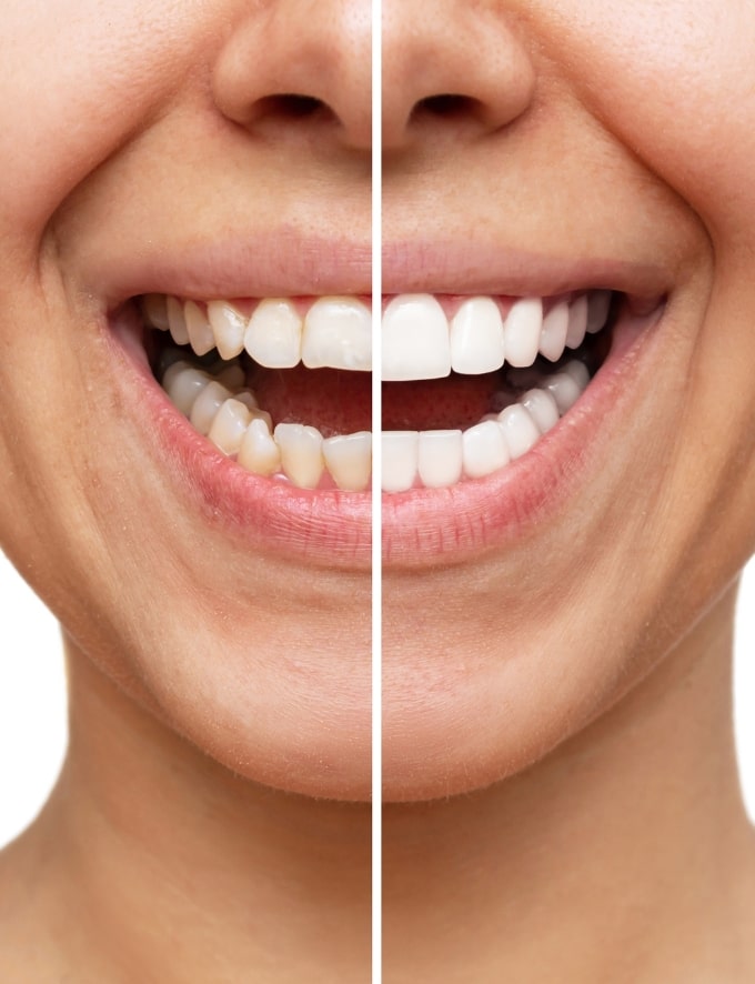 Treatment Category - Conway House Dental