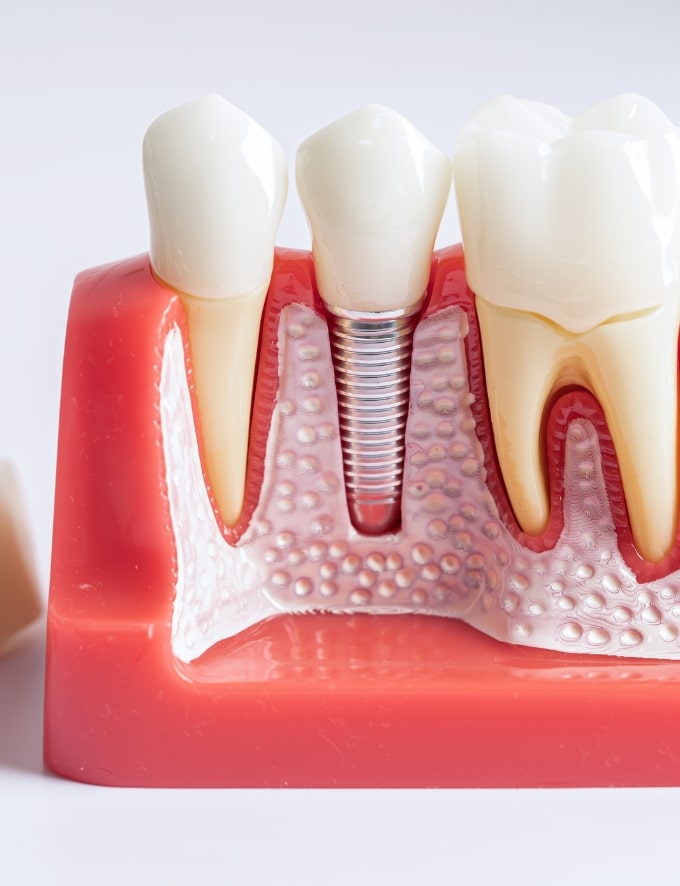 Treatment Category - Conway House Dental