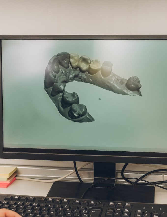 Treatment Category - Conway House Dental