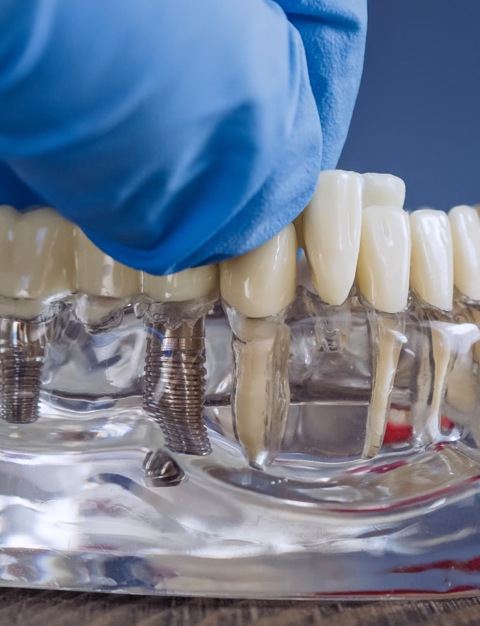 Treatment - Conway House Dental